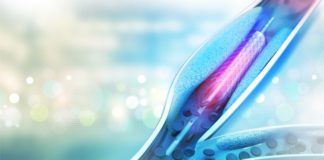 Stent ultrasottile a rilascio di farmaco