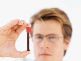 Gilteritinib per la leucemia acuta mieloide recidivante o refrattaria con mutazione FLT3