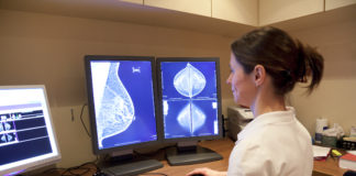 Rimborsabile in Lombardia test genomico per guidare la scelta della chemioterapia nei tumori al seno