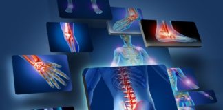 Patologie reumatiche e diabete