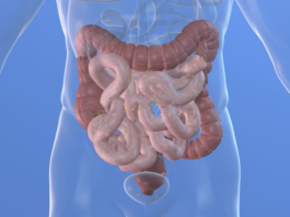 Registro Nazionale Spondiloartriti Enteropatiche