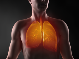Nintedanib per diverse malattie interstiziali polmonari fibrosanti progressive