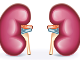 Avelumab/axitinib per il carcinoma renale avanzato