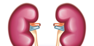 Avelumab/axitinib per il carcinoma renale avanzato