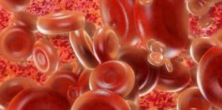 Eryaspase (L-asparaginasi incapsulata nei globuli rossi) per il carcinoma pancreatico Eryaspase carcinoma pancreatico
