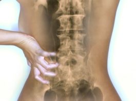 Dati su secukinumab nella gestione delle manifestazioni assiali in corso di artrite psoriasica Per la prima volta secukinumab mette in relazione tra loro i trattamenti della psoriasi, dell’artrite psoriasica e delle manifestazioni assiali