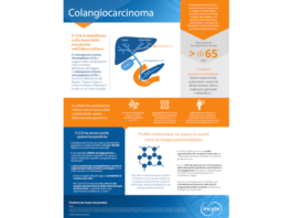 Colangiocarcinoma o cancro dei dotti biliari (CCA)