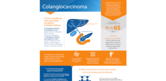 Colangiocarcinoma o cancro dei dotti biliari (CCA)