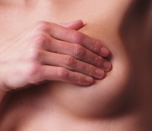 Formulazione sottocutanea di pertuzumab e trastuzumab per il tumore al seno HER2-positivo pertuzumab e trastuzumab sottocute