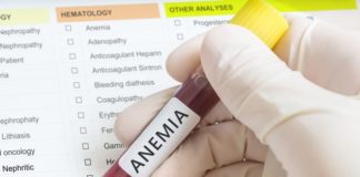 Carenza di ferro carenza di ferro e anemia sideropenica