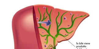 Pemigatinib per il colangiocarcinoma Pemigatinib per il colangiocarcinoma