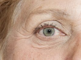 Possibilità terapeutiche per la degenerazione maculare legata all’età degenerazione maculare legata all'età