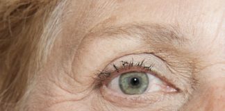 Possibilità terapeutiche per la degenerazione maculare legata all’età degenerazione maculare legata all'età