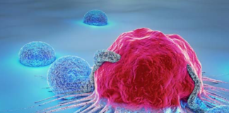 Opinione positiva Chmp per l’aggiornamento delle indicazioni della terapia anti-PD1 di MSD