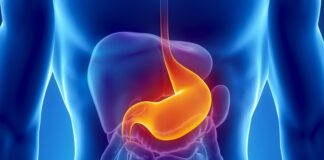 Carcinoma gastrico, FDA approva l’uso del farmaco Enhertu