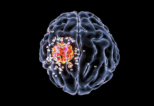 Glioblastoma, un contributo alla ricerca dalla nanomedicina