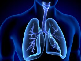 Mesotelioma maligno, approvata una nuova terapia di combinazione