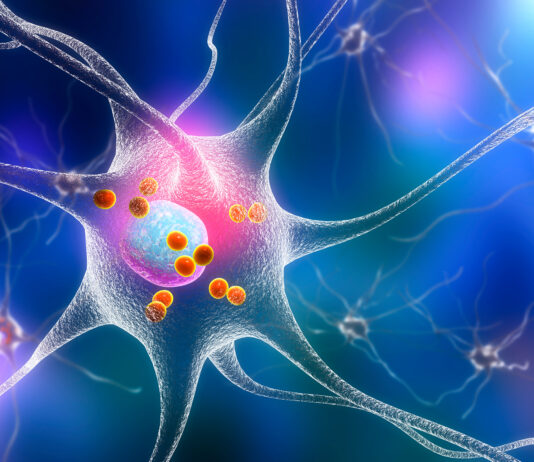 Fda, un nuovo trattamento transdermico del morbo di Alzheimer
