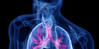 NCFB, da FDA una nuova designazione di “breakthrough therapy”