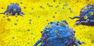 AI CUrES, un progetto per indagare il potenziale dell’IA nel predire le metastasi