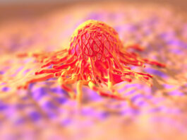 DDC, un finanziamento per la ricerca sulle terapie oncologiche