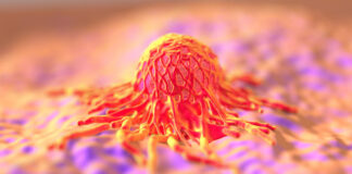 DDC, un finanziamento per la ricerca sulle terapie oncologiche