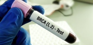 Tumore al seno metaplastico, rivelata l’origine ereditaria