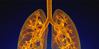 Ipertensione arteriosa polmonare: verso terapie su misura