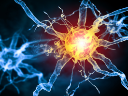 Rimborsabile la nuova terapia sottocutanea per la miastenia grave