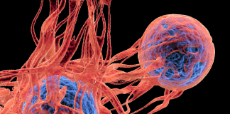 L’AI per predire la risposta dei pazienti nell’immunoterapia oncologica