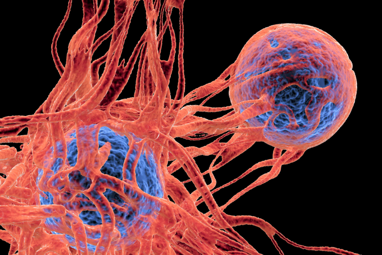 L’AI per predire la risposta dei pazienti nell’immunoterapia oncologica