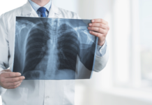 AIFA, accesso allargato per i medicinali per la fibrosi cistica