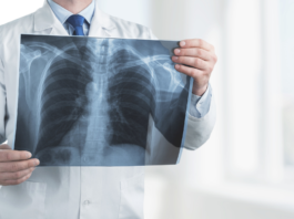 AIFA, accesso allargato per i medicinali per la fibrosi cistica