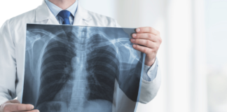 AIFA, accesso allargato per i medicinali per la fibrosi cistica