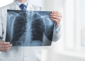 AIFA, accesso allargato per i medicinali per la fibrosi cistica