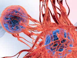 Il Beating Cancer Plan compie cinque anni Cellule tumorali