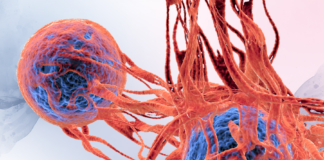 Il Beating Cancer Plan compie cinque anni Cellule tumorali