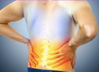 Sindrome di Bertolotti: un’anomalia spesso ignorata