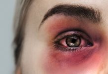 SIOT contro fake news e violenza domestica: le linee guida per gli ortopedici