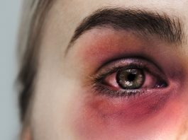 SIOT contro fake news e violenza domestica: le linee guida per gli ortopedici