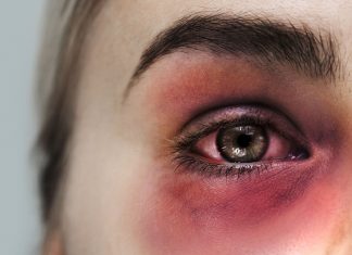 SIOT contro fake news e violenza domestica: le linee guida per gli ortopedici