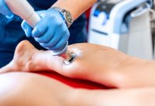 Onde d’urto focali e onde di pressione radiali: indicazioni e controindicazioni