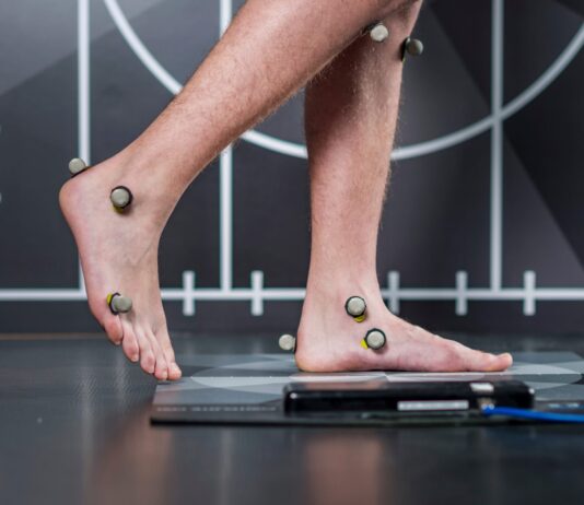 Nuovi metodi per valutare la biomeccanica del passo