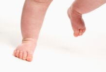 Cammino con le punte in dentro nel bambino: i plantari propriocettivi possono aiutare?