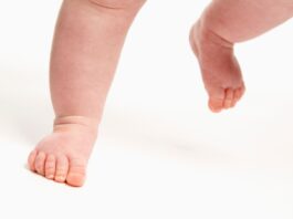 Cammino con le punte in dentro nel bambino: i plantari propriocettivi possono aiutare?
