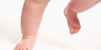 Cammino con le punte in dentro nel bambino: i plantari propriocettivi possono aiutare?