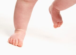 Cammino con le punte in dentro nel bambino: i plantari propriocettivi possono aiutare?