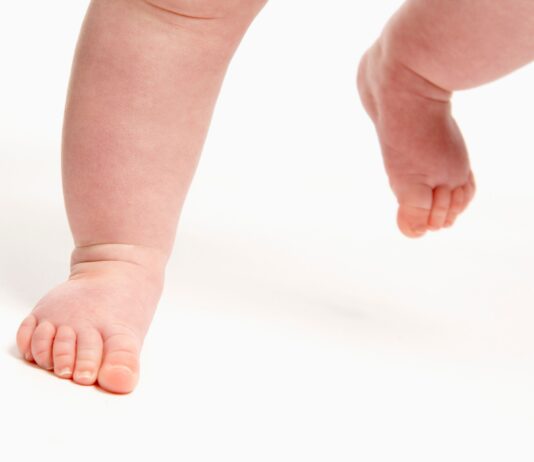 Cammino con le punte in dentro nel bambino: i plantari propriocettivi possono aiutare?