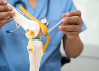 Gonartrosi e tutore per ginocchio valgo: gli esiti effettivi