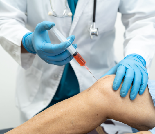 PRP, l'efficacia nell'artrosi traumatica di anca e ginocchio: un confronto